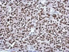 Anti-CGGBP1 antibody [N1C3] used in IHC (Paraffin sections) (IHC-P). GTX115103