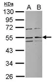 Anti-RRP1 antibody [N2C2], Internal used in Western Blot (WB). GTX115108