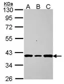 Anti-AKR7A2 antibody [N3C3] used in Western Blot (WB). GTX115109