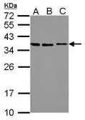 Anti-Stanniocalcin 2 antibody used in Western Blot (WB). GTX115113