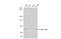 Anti-VDP / p115 antibody [N1N2], N-term used in Western Blot (WB). GTX115114