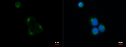 Anti-VDP / p115 antibody used in Immunocytochemistry/ Immunofluorescence (ICC/IF). GTX115115