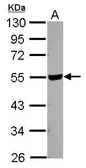 Anti-HYAL2 antibody [N2C2], Internal used in Western Blot (WB). GTX115123
