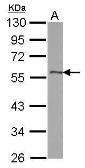 Anti-DLK1 antibody used in Western Blot (WB). GTX115136