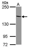 Anti-TIF1 alpha antibody [N1N3] used in Western Blot (WB). GTX115139