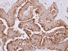 Anti-CES2 antibody used in IHC (Paraffin sections) (IHC-P). GTX115142