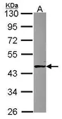Anti-ABH1 antibody [N3C3] used in Western Blot (WB). GTX115145