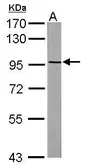 Anti-PAG3 antibody [N1N2], N-term used in Western Blot (WB). GTX115146