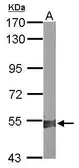 Anti-ALDH1A2 antibody [C1C3] used in Western Blot (WB). GTX115148