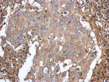 Anti-ST3GAL5 antibody [N3C3] used in IHC (Paraffin sections) (IHC-P). GTX115152