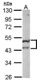 Anti-ST3GAL5 antibody [N3C3] used in Western Blot (WB). GTX115152