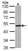 Anti-ST3GAL5 antibody [N3C3] used in Western Blot (WB). GTX115152