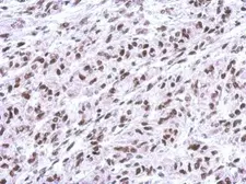 Anti-FUBP1 antibody used in IHC (Paraffin sections) (IHC-P). GTX115154