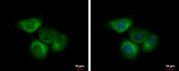Anti-EIF2B delta antibody used in Immunocytochemistry/ Immunofluorescence (ICC/IF). GTX115155
