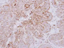 Anti-GYG2 antibody used in IHC (Paraffin sections) (IHC-P). GTX115157