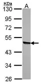 Anti-KYNU antibody [N2C2], Internal used in Western Blot (WB). GTX115169