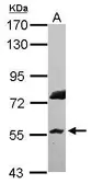 Anti-RNF8 antibody [N3C3] used in Western Blot (WB). GTX115176