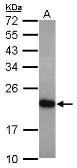 Anti-UNC119 antibody [N2C3] used in Western Blot (WB). GTX115185