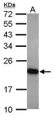 Anti-UNC119 antibody [N2C3] used in Western Blot (WB). GTX115185