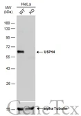 Anti-USP14 antibody used in Western Blot (WB). GTX115187