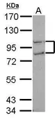 Anti-FCP1 antibody [N1N2], N-term used in Western Blot (WB). GTX115194