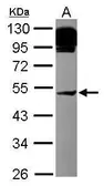 Anti-AP4M1 antibody [N1N3] used in Western Blot (WB). GTX115195