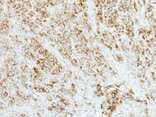 Anti-AP4M1 antibody [N1C1] used in IHC (Paraffin sections) (IHC-P). GTX115196