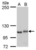 Anti-NOLC1 antibody used in Western Blot (WB). GTX115205