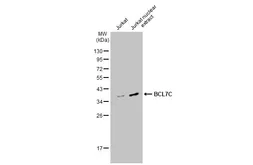 Anti-BCL7C antibody used in Western Blot (WB). GTX115214