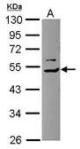 Anti-TRIP15 antibody used in Western Blot (WB). GTX115217