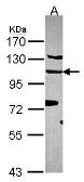 Anti-EFTUD2 antibody [C1C3] used in Western Blot (WB). GTX115222