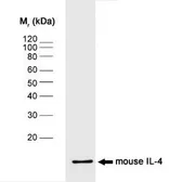 Anti-IL4 antibody [BVD4-1D11] used in Western Blot (WB). GTX11524