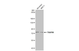 Anti-TRAP80 antibody [C1C3] used in Western Blot (WB). GTX115241