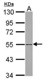 Anti-SH3BP5 antibody [N3C3] used in Western Blot (WB). GTX115245