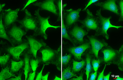 Anti-NPEPPS antibody [N3C2-2], Internal used in Immunocytochemistry/ Immunofluorescence (ICC/IF). GTX115247