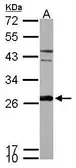 Anti-Peroxiredoxin 6 antibody used in Western Blot (WB). GTX115262