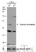 Anti-Guanine deaminase antibody used in Western Blot (WB). GTX115264