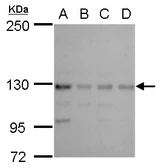 Anti-CTR9 antibody [N1N2], N-term used in Western Blot (WB). GTX115267