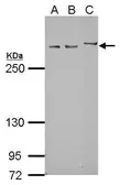 Anti-Myomegalin antibody [N1], N-term used in Western Blot (WB). GTX115270
