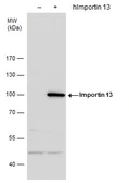 Anti-Importin 13 antibody [N1N2], N-term used in Western Blot (WB). GTX115274