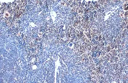 Anti-TOX antibody [N1C1] used in IHC (Paraffin sections) (IHC-P). GTX115287