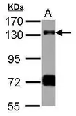 Anti-RNF40 antibody [N3C1-2], Internal used in Western Blot (WB). GTX115294