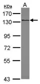 Anti-RNF40 antibody [N1N2], N-term used in Western Blot (WB). GTX115295