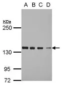 Anti-DDX46 antibody [C2C3], C-term used in Western Blot (WB). GTX115308