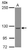 Anti-Strumpellin antibody [C2C3], C-term used in Western Blot (WB). GTX115311