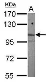 Anti-ARNT2 antibody [N2C1], Internal used in Western Blot (WB). GTX115314