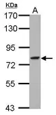 Anti-GFPT2 antibody used in Western Blot (WB). GTX115319