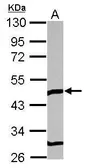 Anti-TOM1L1 antibody used in Western Blot (WB). GTX115334