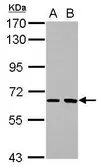 Anti-SH2D3A antibody [N1C2] used in Western Blot (WB). GTX115335