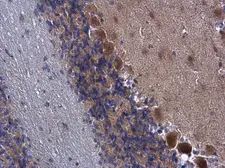 Anti-FARSB antibody used in IHC (Paraffin sections) (IHC-P). GTX115336